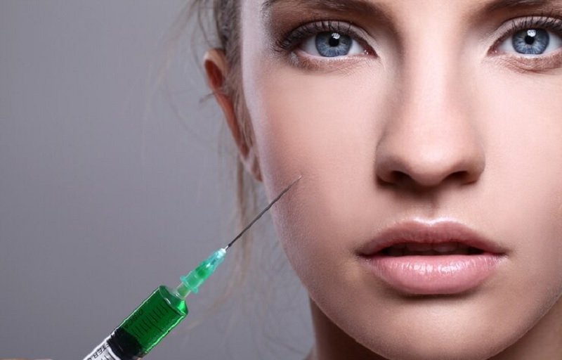 Hyaluronic Acid Fillers